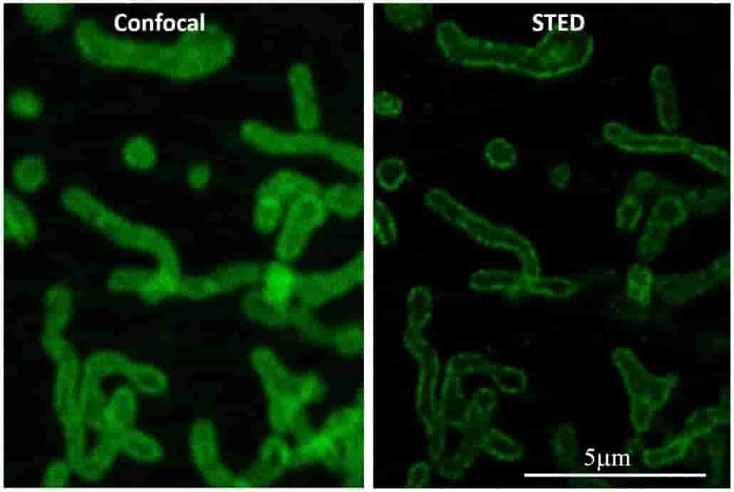 confocal and sted images for superresolution
